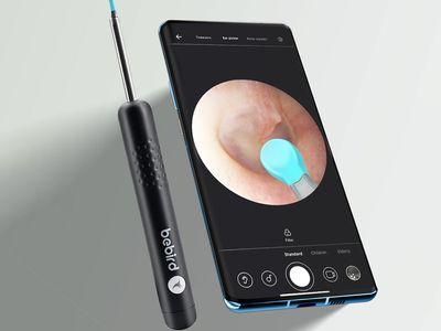 Ear Wax Removal Endoscope Bebird Wireless Visual Smart Ear Cleaner